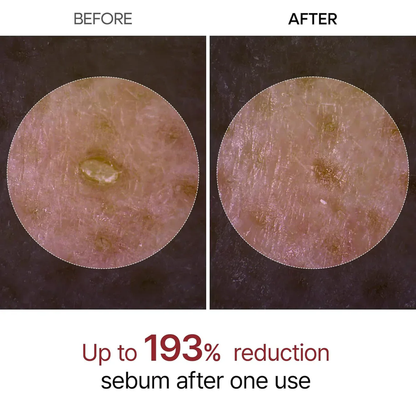 Dr. Melaxin – Peel Shot™